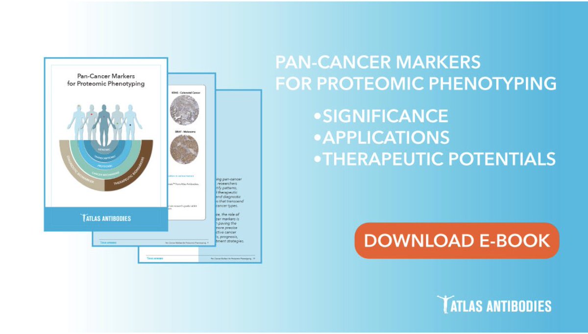 E-Book: 'Pan-Cancer Markers for Proteomic Phenotyping' 👇 Download your free copy now: atlasantibodies.com/knowledge-hub/… #Research #Antibodies #CancerResearch #Proteomicphenotyping #PanCancerMarkers #atlasantibodies #PrecisAMonoclonals #TripleAPolyclonals #ihc #westernblot #icc