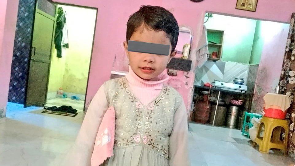 Shubhamshuklamp's tweet photo. 3 साल की इस मासूम का क्या कसूर था? पहली तस्वीर उसके हंसते खेलते जीवित रहते बचपने की है। दूसरी तस्वीर उसकी निर्मम हत्या के बाद का दृश्य। बच्ची के दोनों पैर कटे हैं। दोनों हाथ रस्सी से बंधे थे। चेहरा पालिथीन से ढका था। इतनी हैवानियत से हत्या की है दरिंदों ने। परिजनों ने सगीर अहमद और उसकी पत्नी सायरा बानो पर आरोप लगाया है। ऐसा कुकर्म सिर्फ़ पिशाच कर सकते हैं, मानव नहीं। घटना UP के रामपुर की।
