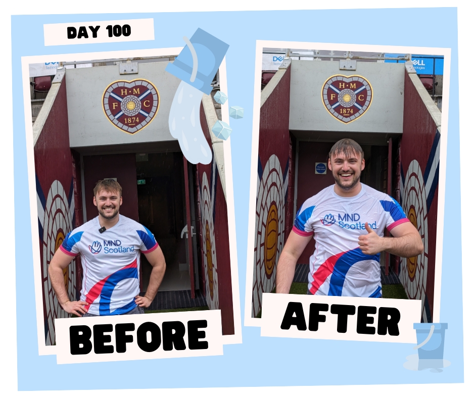 Greg is doing an Ice Bucket every day this year to raise money for vital MND research. The 9th of April was his 100th Ice Bucket! Share your applause and messages of support in the comments below to spur on Greg in this amazing challenge!