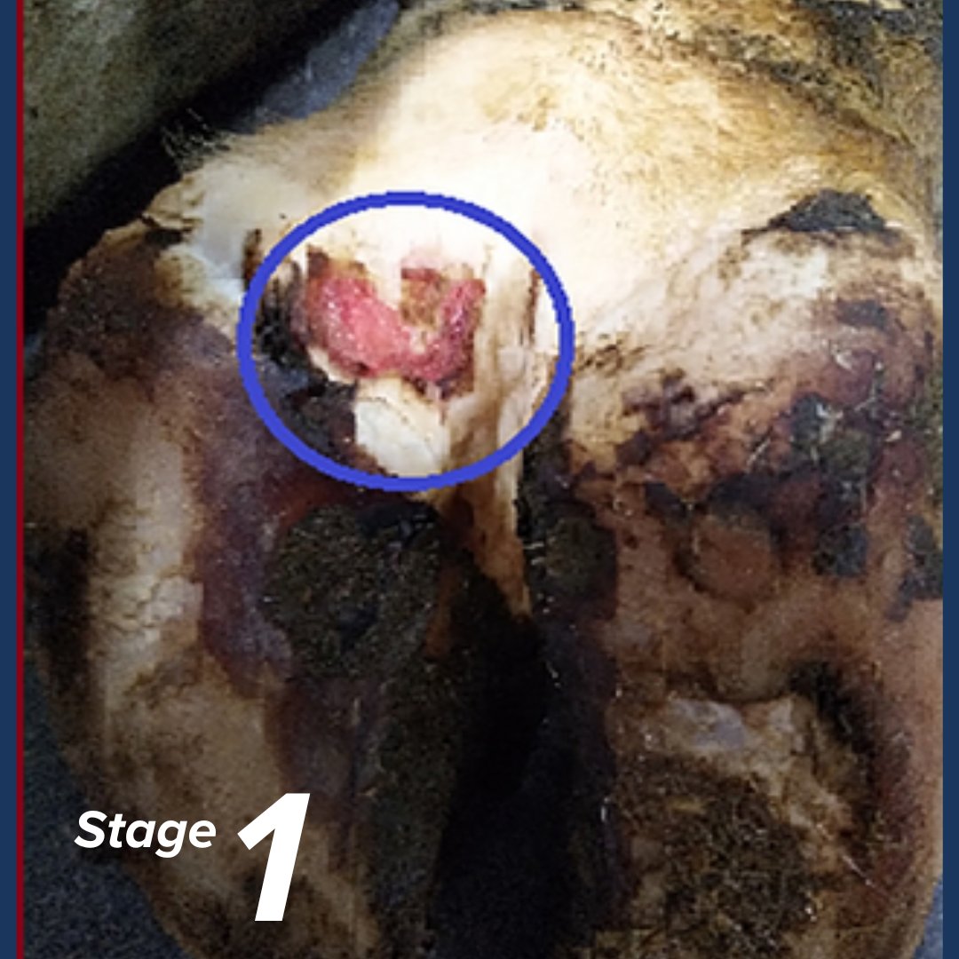 Suspect you have Mortellaro? What stage is it at?

Proliferative (Hairy) Stage:
Stage 1: M1 Lesion - This is the initial stage of digital dermatitis.

The M1 lesion appears as a small, circular, inflamed, and reddened area.. Read more here simplebooklet.com/dddigitalderma…

#hoofcare