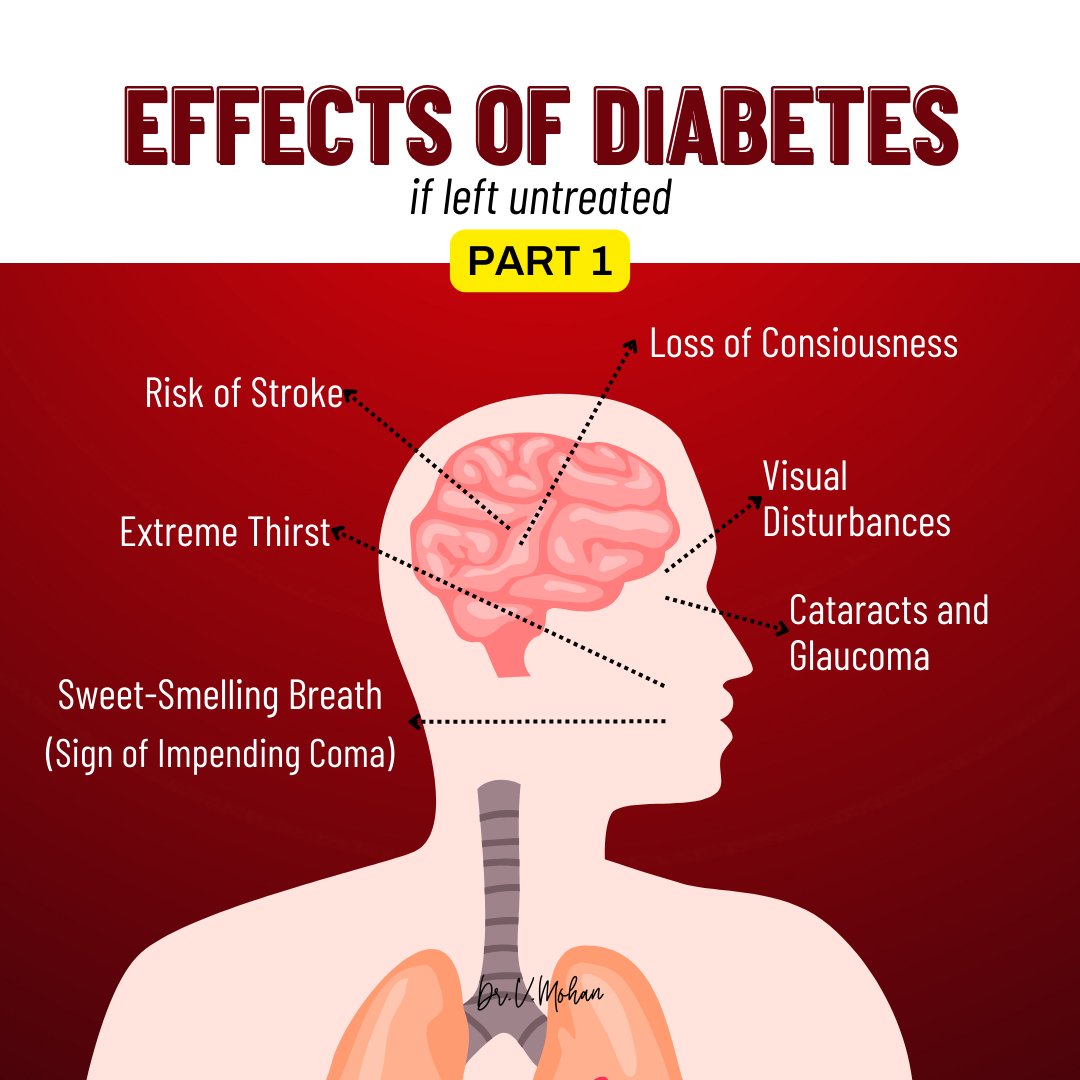 Neglecting diabetes can lead to a range of serious repercussions. From the heightened risk of brain strokes and loss of consciousness to persistent thirst and vision impairment, including conditions like cataracts and glaucoma. Additionally, the presence of sweet-smelling breath…