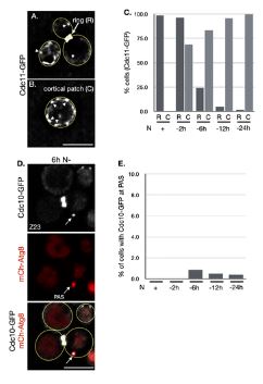FROM MBoC Septins limit autophagy by forming spatially discrete assemblies around ER-exit sites. molbiolcell.org/doi/10.1091/mb… @ucdavis