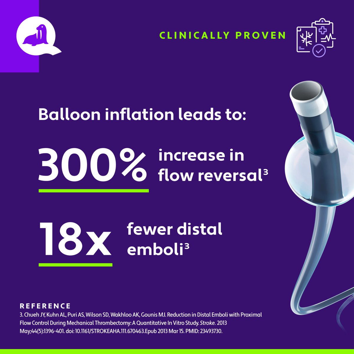 Balloon Guide Catheter utilization in acute ischemic stroke thrombectomy makes a difference - clinically proven. #WALRUS #QapelMedical #BGC