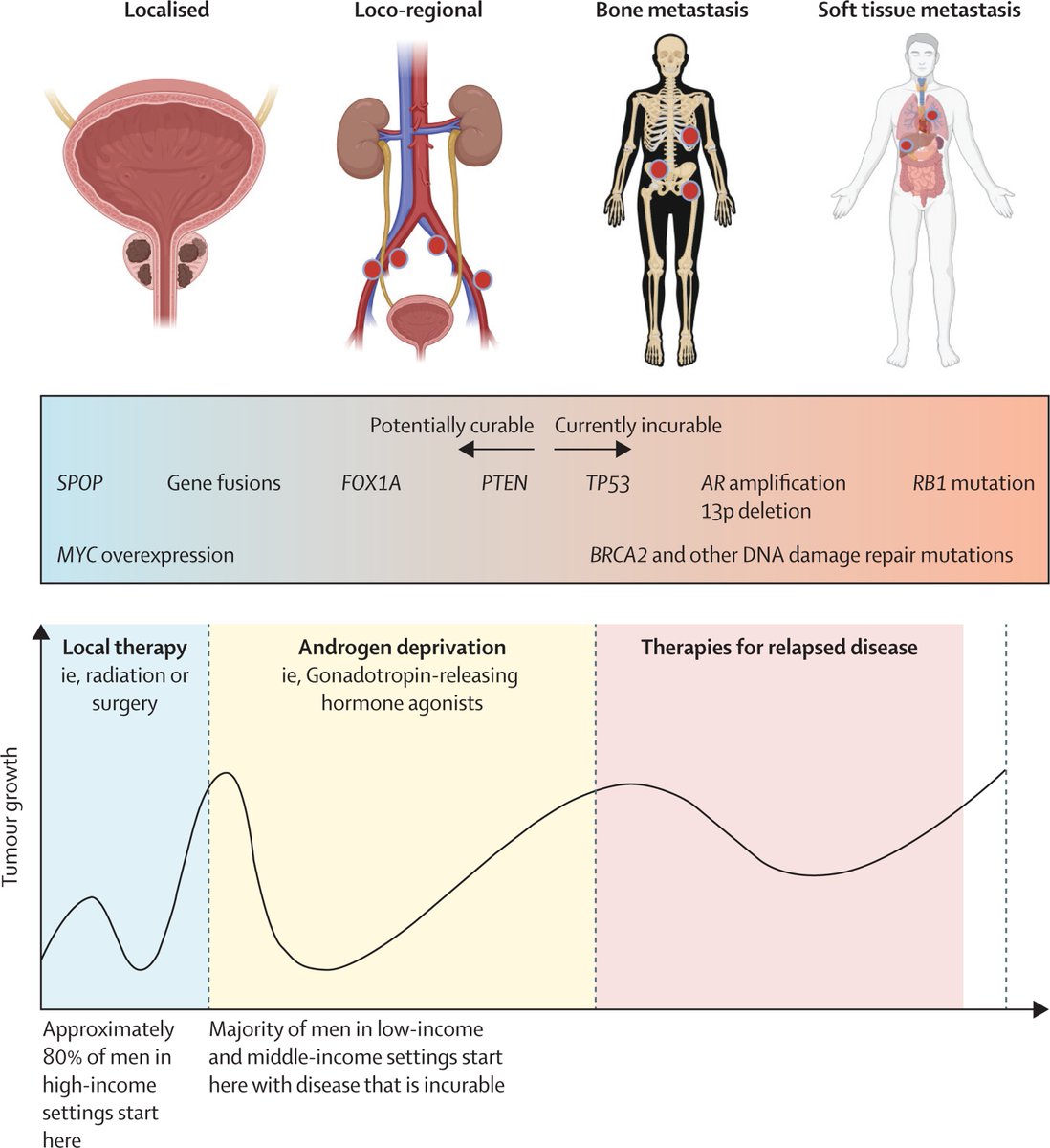 Prostate cancer cases are projected to double to 2.9 million per year by 2040. 🆕 A Lancet Commission outlines evidence-based interventions, such as improved early detection & education programmes, to help save lives & prevent related ill health. hubs.li/Q02snzFs0