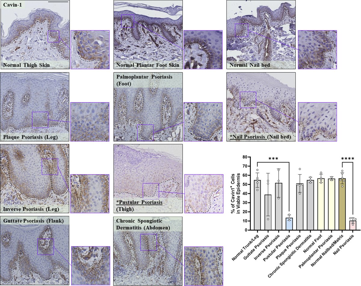 From the March issue: New structural membrane proteins as targets in #psoriasis ow.ly/UU7f50QHMSw #derm #dermatology