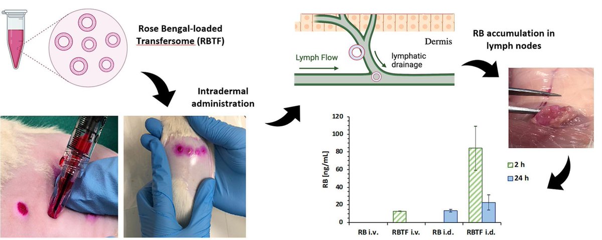 Improved pharmacokinetic and lymphatic uptake of Rose Bengal after transfersome intradermal deposition using hollow microneedles. | Ryan F. Donnelly @pharmacyatQUB | @UKICRS @ryanfdonnelly [50 days' free access] #microneedle #transferosome #RoseBengal authors.elsevier.com/sd/article/S01…