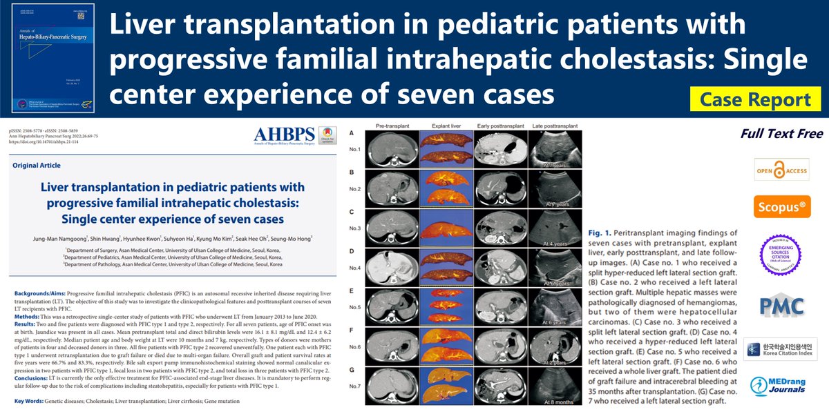 Liver transplantation in pediatric patients with progressive familial intrahepatic cholestasis: Single center experience of seven cases 🌷doi.org/10.14701/ahbps… 2024 Feb;28(1)Jung-Man Namgoong #Genetic_diseases #Cholestasis #Liver_transplantation #Liver_cirrhosis #Gene_mutation