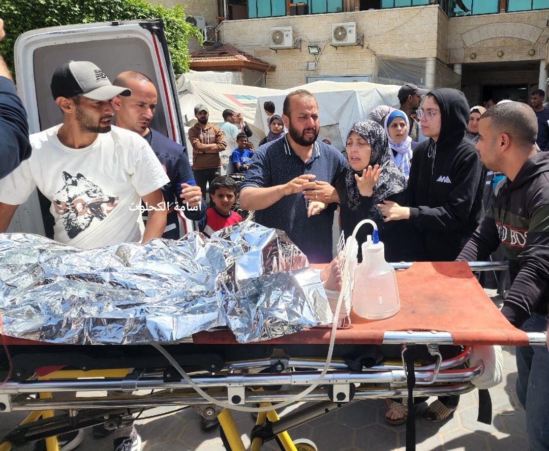 ⚡️ The scenes of pain do not stop in the courtyard of Al-Aqsa Hospital