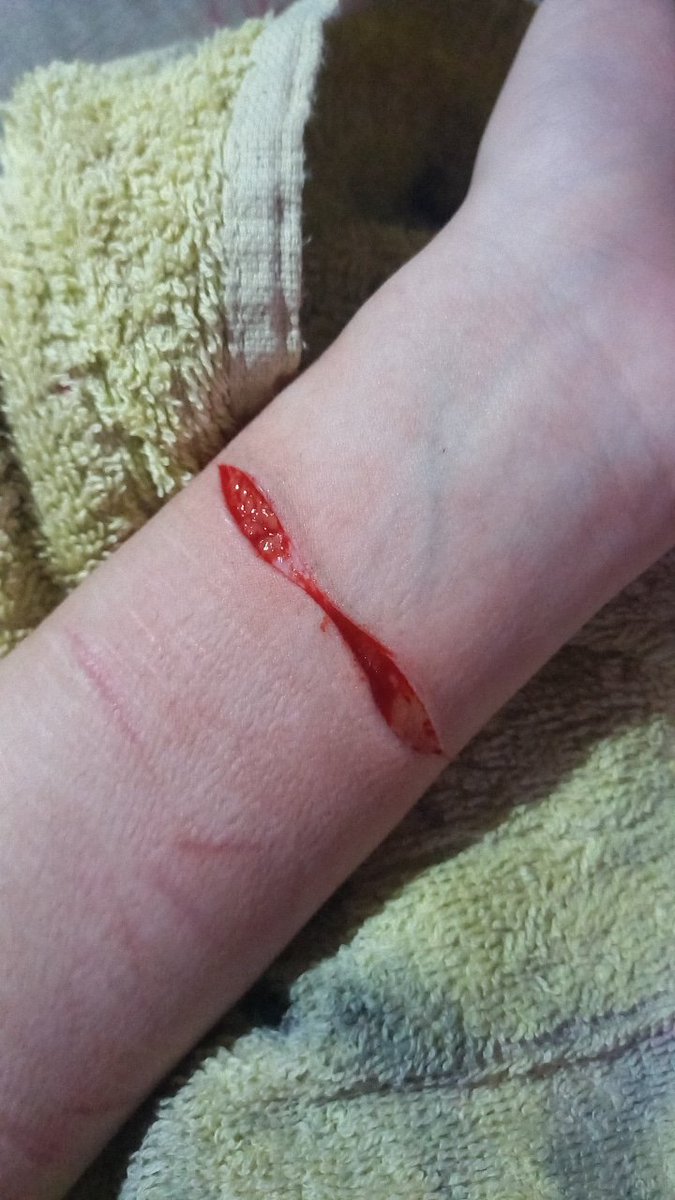ponzunoob's tweet photo. MUTIS Y NO MUTIS AYUDA POR FAVOR me acabo de hacer un bean se suponía que estaba en recovery desde hace 4 meses, le digo a mi mamá para que me lleven a ponerme puntos o que hago? 😭😭 https://t.co/fi6S0UofGc