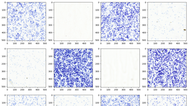 Uncover the power of decoding DICOM medical images with AWS HealthImaging using nvJPEG2000. Explore GPU-accelerated solutions for efficient image processing. Learn more in our blog. #ai #medicalimaging bit.ly/3Uvzdhm