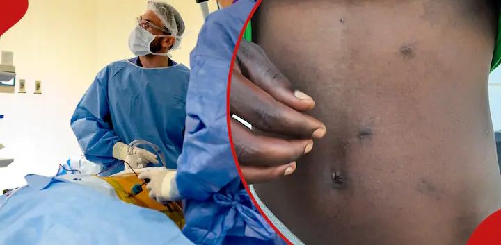E__TEN__'s tweet photo. Ben confessed that he sold his kidney at KSh 500,000 in Eldoret in order to pay school fees for his orphaned siblings. He also used part of the money to buy a motorbike. A year later, he says his health has been deteriorating
#joelogolla
#fidelodinga
#Ruaka
#Kenyapower https://t.co/FgCEbd9pTk