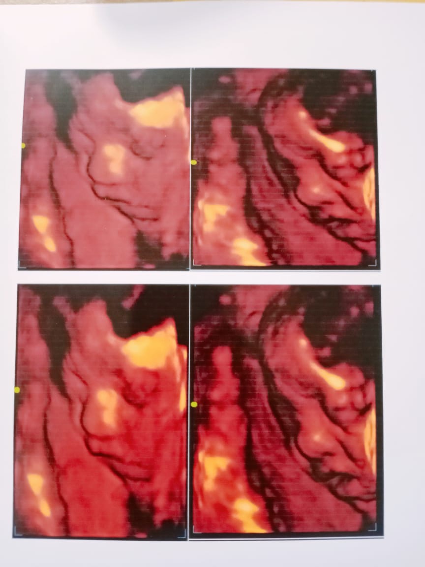 22 April 2024, I'm eagerly anticipating the arrival of my first son in just three months! He's so adorable and handsome, and I couldn't be more excited. 😙😙😙👪