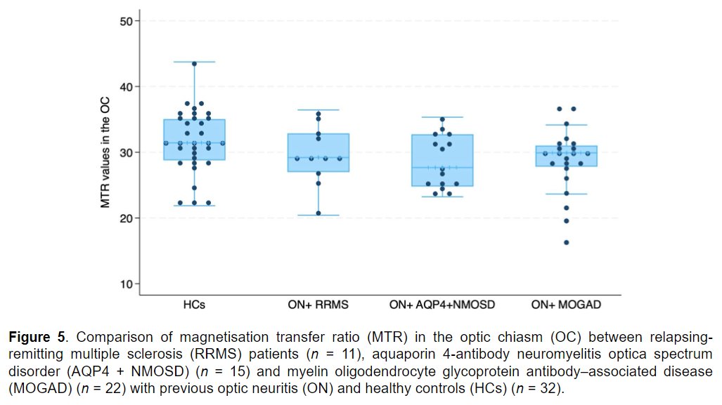 MSJ (@msj_research) on Twitter photo Clinical, MRI and OCT evaluation of the optic chiasm in #MultipleSclerosis, AQ4+ neuromyelitis optica spectrum disorder #NMOSD, and MOG–associated disease #MOGAD.
Study from <a href="/alessia_bia/">Alessia Bianchi</a> <a href="/ahmedtoosy/">ahmedtoosy</a> <a href="/QSMSCENTRE/">QueenSquareMSCentre</a> <a href="/UCLBrainScience/">UCL Brain Sciences</a> ▶️ journals.sagepub.com/doi/10.1177/13… Clinical, MRI and OCT evaluation of the optic chiasm in #MultipleSclerosis, AQ4+ neuromyelitis optica spectrum disorder #NMOSD, and MOG–associated disease #MOGAD.
Study from <a href="/alessia_bia/">Alessia Bianchi</a> <a href="/ahmedtoosy/">ahmedtoosy</a> <a href="/QSMSCENTRE/">QueenSquareMSCentre</a> <a href="/UCLBrainScience/">UCL Brain Sciences</a> ▶️ journals.sagepub.com/doi/10.1177/13…