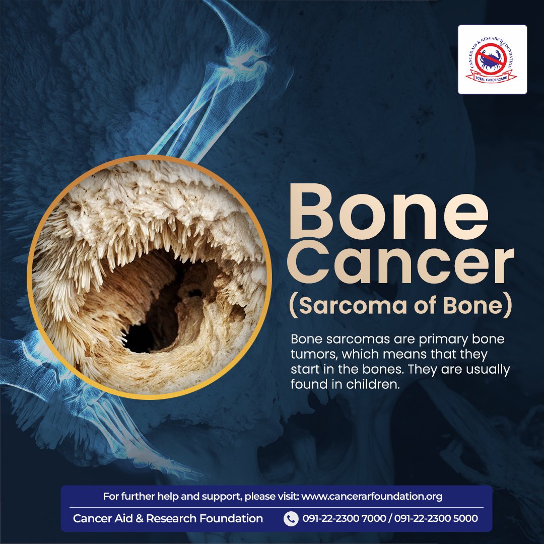 Bone sarcomas are primary bone tumors that typically affect children. Early detection and treatment are key. 🔗 For more details, visit us at: cancerarfoundation.org . . .