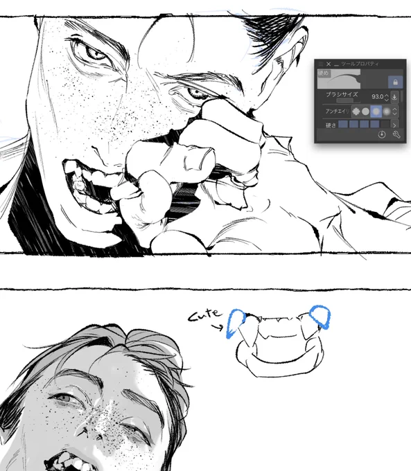 🤷‍♂️🦷 