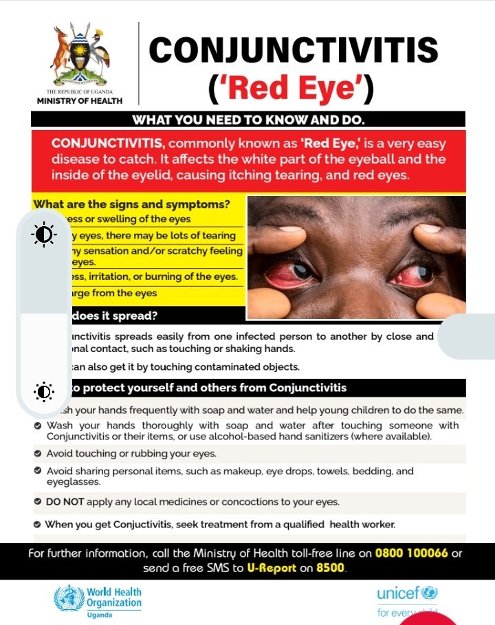 'Red Eye' is a self-limiting infection. Follow these @MinofHealthUG preventive measures and you will defeat this infection