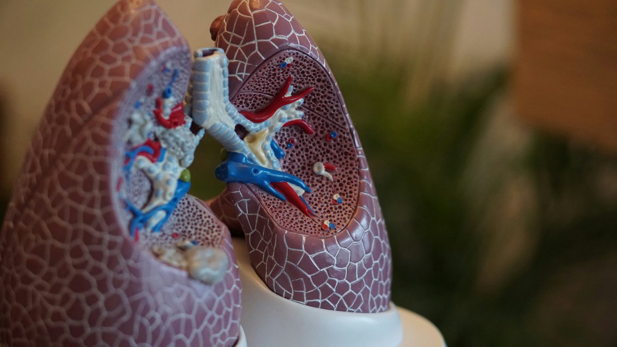 IRR researchers announce a £9.4 million collaborative research centre to tackle rare lung diseases. The @LifeArc Centre for Rare Respiratory Diseases will accelerate improved tests, treatments and potentially cures for thousands of people 🫁 ed.ac.uk/regeneration-r…