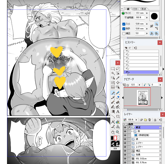 腸壁越しに確認できる内臓の形。 