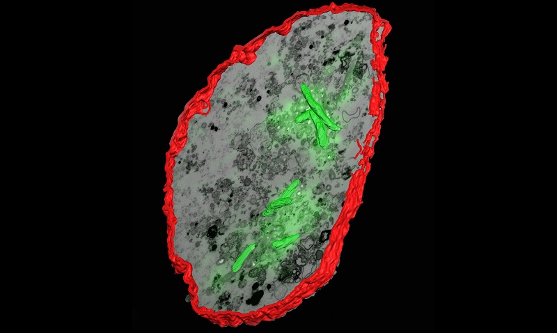 ¿Sabías que? La bacteria responsable de la tuberculosis (Mycobacterium tuberculosis) puede esconderse y vivir dentro de las mismas células inmunitarias que se envían para cazarla y matarla. Al igual que Jonás, después de ser tragado por la ballena, M. tuberculosis puede
1/