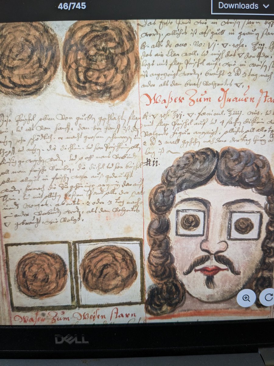 I'm 'reading' an early modern German medical text ('Arzneibuch', Wellcome MS. 990), which means I'm just looking at pictures, and I'm so confused. CW for premodern images of wounds and body horror. See e.g. 💩 for eyes?