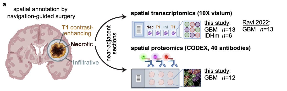 To answer this question, we profiled glioma samples by spatial transcriptomics & proteomics. For analysis, we integrated our Visium dataset with samples from Ravi et al. (doi.org/10.1016/j.ccel…). 3/