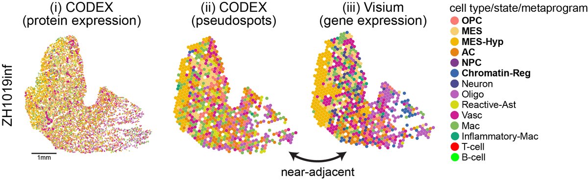 Visium covers most genes but lacks true single-cell resolution. Therefore, we designed an Ab panel based on sc signatures & used CODEX as a validation. We could also generate Visium-sized pseudospots over the CODEX data to ask questions about their ground truth composition. 6/