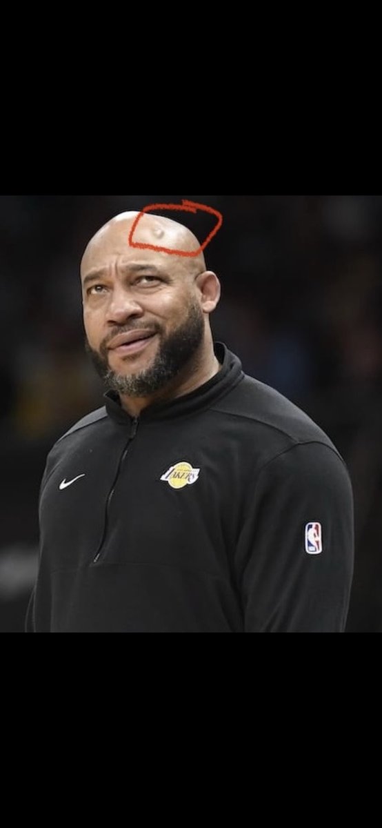 Camsta0's tweet photo. AND WHAT THE FUCK IS THIS THING ON HIS HEAD THIS SHIT PISSES ME OFF!!!! CHOKES A 20 POINT LEAD AND JUST STANDS THERE LIKE A STUPID FUCK!!! FUCK YOU FOR WASTING LEBEONS CAREER https://t.co/15Z6p2m1bZ