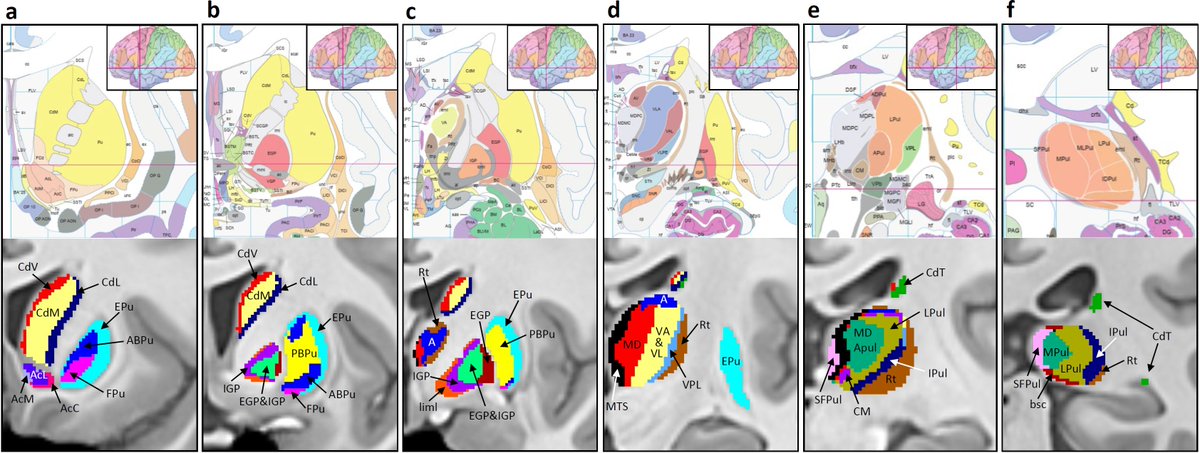 It showed remarkable concordance with histology based atlas delineations.