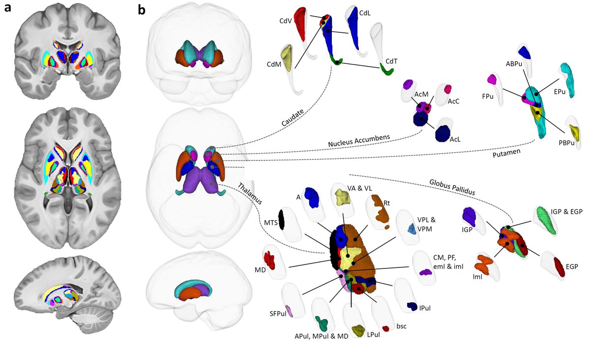 Sydney Subcortical Gray Matter (SydSGM) #parcellation: data driven (T1, T2 and diffusion MRI) in vivo parcellation of human subcortex. Preprint: doi.org/10.21203/rs.3.…