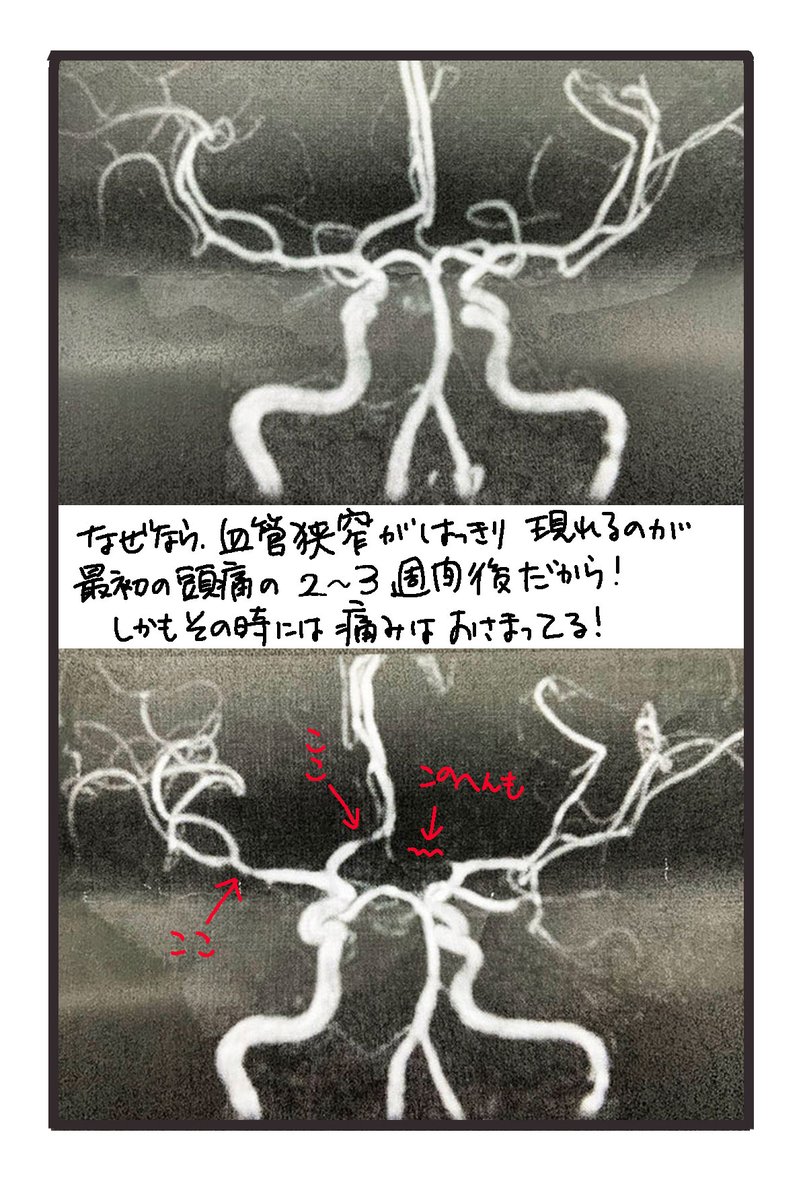 ⑭
私はこの最後の確定のためのMRIが2週間後なのです。
つまりフライングでこれ描いてます😇😇 