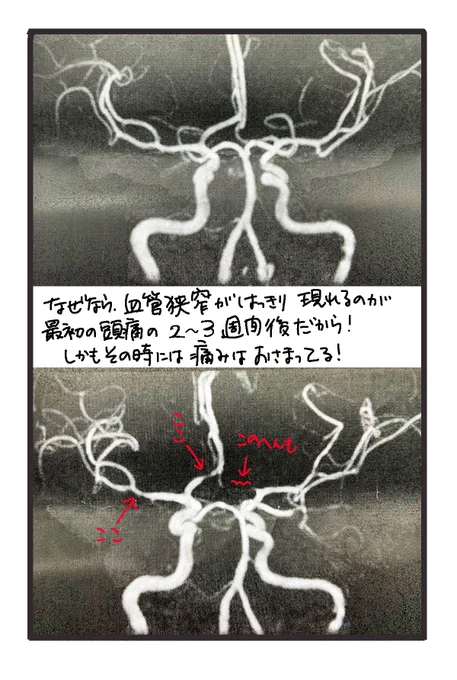 ⑭
私はこの最後の確定のためのMRIが2週間後なのです。
つまりフライングでこれ描いてます😇😇 