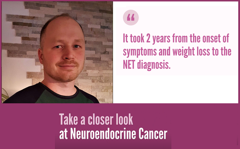 👉Julian from Germany spent 2 years with symptoms of weight loss, flushing and diarrhea. The NET diagnosis came after visiting a third doctor. He already had metastasis to the liver. 📲Watch Julian’s story: incalliance.org/stories/julian… #LetsTalkAboutNETs #GITwitter #OncTwitter