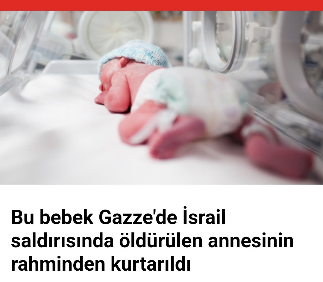 Allah belanızı versin Bu bebek Gazze'de İsrail saldırısında öldürülen annesinin rahminden kurtarıldı. Bütün Dünyanın gözleri önünde.