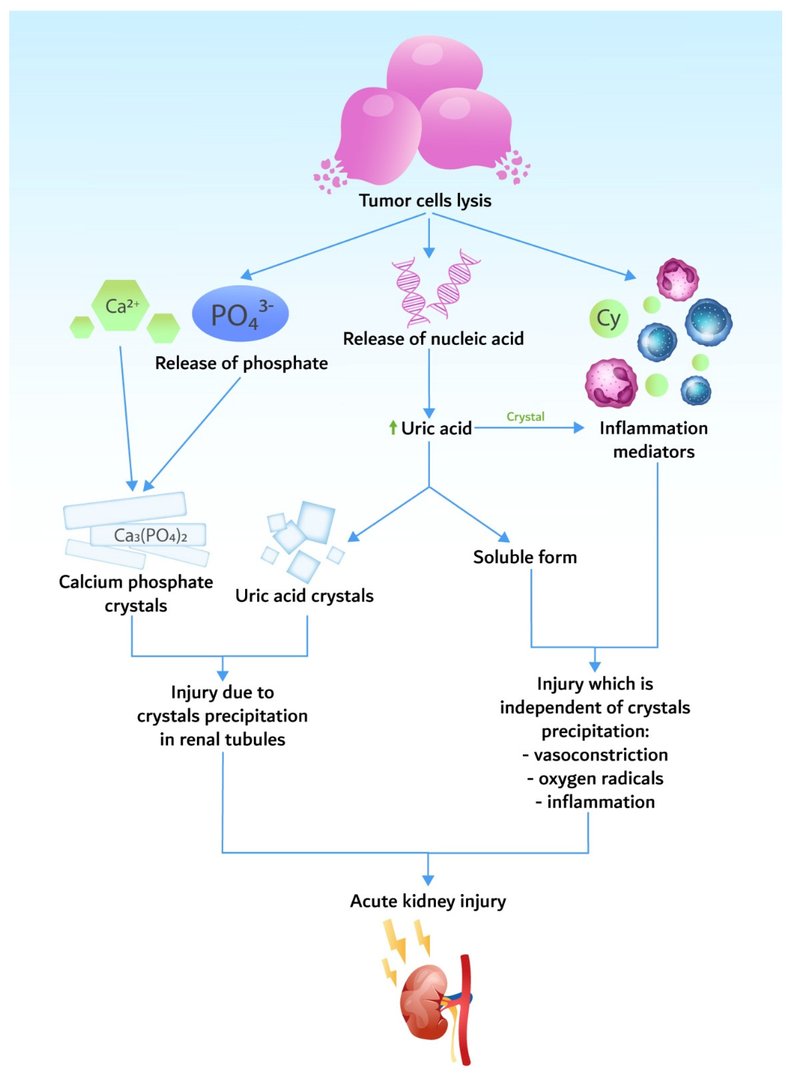 Today's Paper of the Day is on tumor lysis syndrome criticalcarereviews.com/latest-evidenc… Join us to read 1 paper per day and stay up-to-date as we cover the spectrum of critical care across 2024