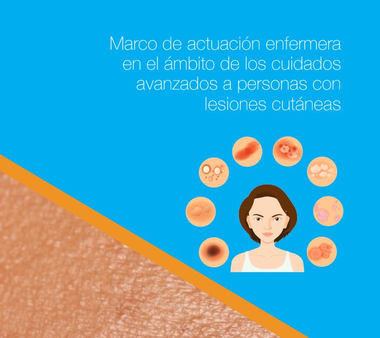 🔴 Nuevo marco de actuación enfermera en el ámbito de los cuidados avanzados a personas con lesiones cutáneas

🤝 El documento está elaborado, de forma conjunta, por el Instituto de Investigación Enfermera del CGE y el <a href="/GNEAUPP/">@gneaupp</a> 

Descarga gratuita ➡ bit.ly/3xVSrE2