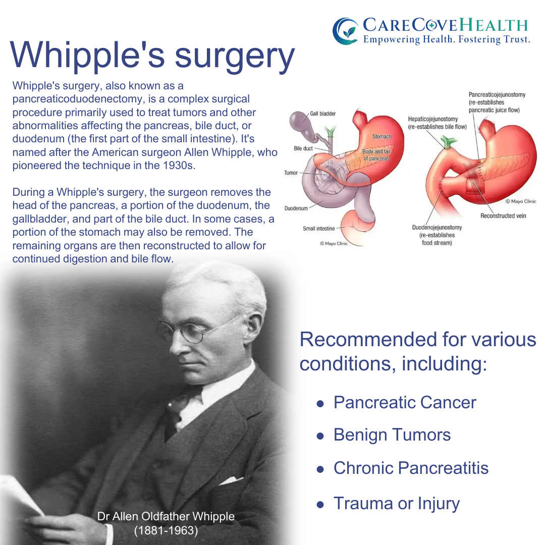 Bravery in the face of challenge! 💪Whipple's surgery, a beacon of hope for those battling pancreatic cancer and other complex conditions. 🌟
#WhipplesWarriors #CourageousJourney #beatingtheodds #HepatocellularCarcinoma