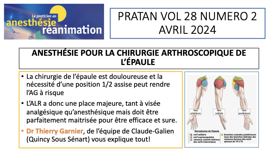 Il faut lire cet article très complet sur l’anesthésie pour chirurgie de l’épaule : comprendre l’innervation, les voies d’abords, les techniques d’ALR et ces risques, la gestion de l’AG. Merci à l’équipe de @Qanesthesie pour cet éclairage !
em-consulte.com/article/165895…