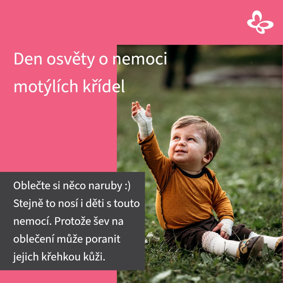 cr_debra's tweet photo. #denNARUBY 2/2 Oblečením čehokoli naruby můžete vyjádřit podporu lidem s nemocí motýlích křídel. 15. května je příležitost k zapojení jak pro celé firmy, školy, party kamarádů tak pro jednotlivce. Rádi k tomu doplním více podrobností nebo vám připravíme Den naruby na míru. https://t.co/hO0jTj5PvI