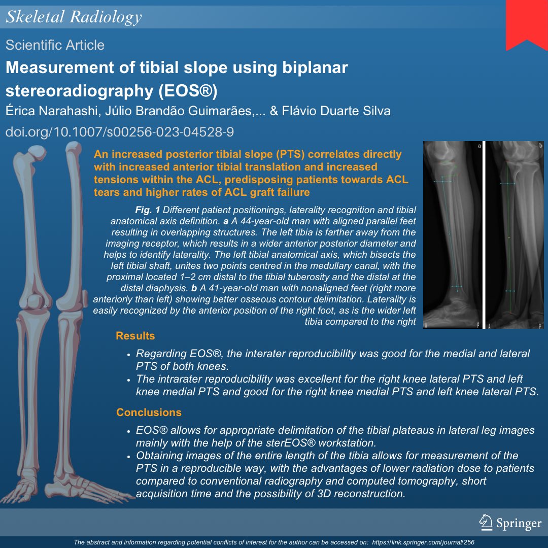 Do you want to learn more about the tibial slope and biplanar stereoradiography? Check out this visual infographic: 🔴 Measurement of tibial slope using biplanar stereoradiography (EOS®) To read the full article: rdcu.be/dwgJY #SkeletalRadiology #mskrad #orthotwitter