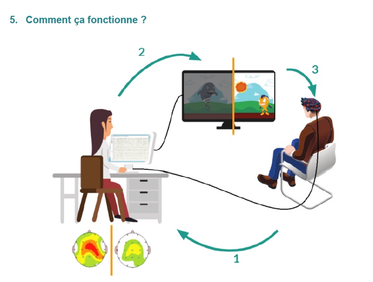 A quoi ressemble une séance de Neurofeedback ? 1. Pendant une séance, votre activité électrique cérébrale est mesurée, via le bonnet d’électrode, par électroencéphalogramme en temps réel. Ces mesures sont envoyées dans l’ordinateur. 2. L’ordinateur est relié à un grand écra ...