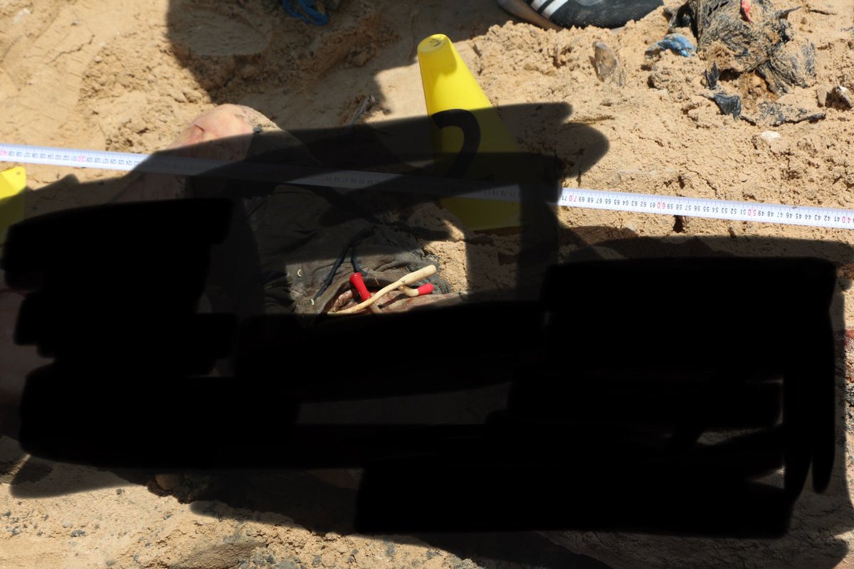 A Palestinian body uncovered from a mass grave and killed by Israeli occupation forces. The part I didn’t blur out are the catheters. This was a patient. Murdered and dumped into a shallow ditch. By Israel. Keep protesting.