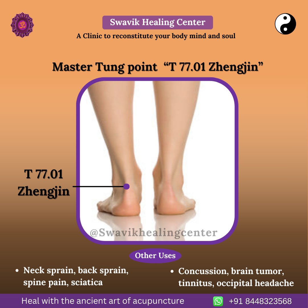 ☯ Master Tung point  “T 77.01 Zhengjin”
☯ Occipital neuralgia is a headache disorder that can cause sudden, sharp head pain.

#acupunctureclinic #acupressurepoints #cuppingmassage #gurugramdiaries #sprain #spinalcordinjury #sciatica #concussion #braintumor #tinnitus #occipital