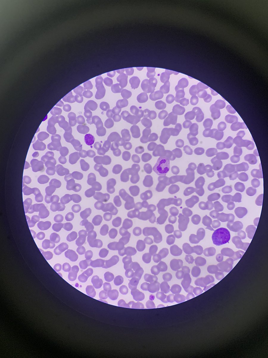 it’s pie ⸱̼ ᵕ ⸱̼ ᷅ ♡̷ tweet media