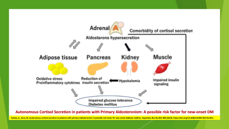 #Mild #Autonomous #Cortisol #Secretion <a href="/endocatracha/">endocatracha</a> <a href="/IndiraFuentes86/">Indira Fuentes</a> <a href="/EndoOncology/">Endocrine Oncology</a> @drcasadocases <a href="/zilbermint/">Mihail "Misha" Zilbermint, MD, MBA</a> <a href="/Endocrinologia4/">Tranqui</a> <a href="/magraziagirone/">mariagrazia girone</a> <a href="/kterinedlourdes/">Dra Katherine Tomedes B</a> <a href="/dramercedesg/">dramgd</a> <a href="/doc_hormone/">Idrees Mubarik</a> <a href="/drshafikuchay/">M Shafi Kuchay</a> @eva3034385615 <a href="/ENDOUNO/">Armand K</a> <a href="/vvdevandr/">Dr Vishnu Vasudevan</a> <a href="/DrIramHussain/">Iram Hussain</a> <a href="/ANISHKAR11/">Anish Kar</a> <a href="/IrinaBancos/">Irina Bancos</a>