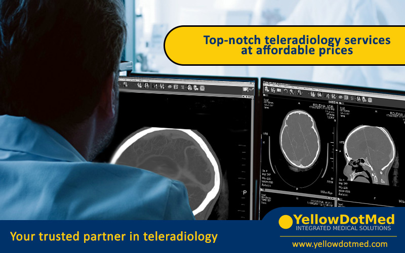 Your destination for premium teleradiology with affordable prices!
Accuracy, accessibility and affordability, performed by the most reputable radiologists, all at competitive prices! Partner with us now! Contact us for a free consultation! yellowdotmed.com/teleradiology/
#Teleradiology