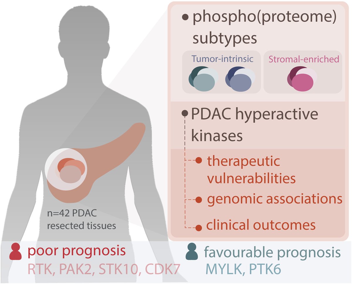 Kinase activities in pancreatic ductal adenocarcinoma with prognostic and therapeutic avenues

🔗buff.ly/49Nrccb

#PDAC #Kinases #PersonalisedMedicine #Phosphoproteome