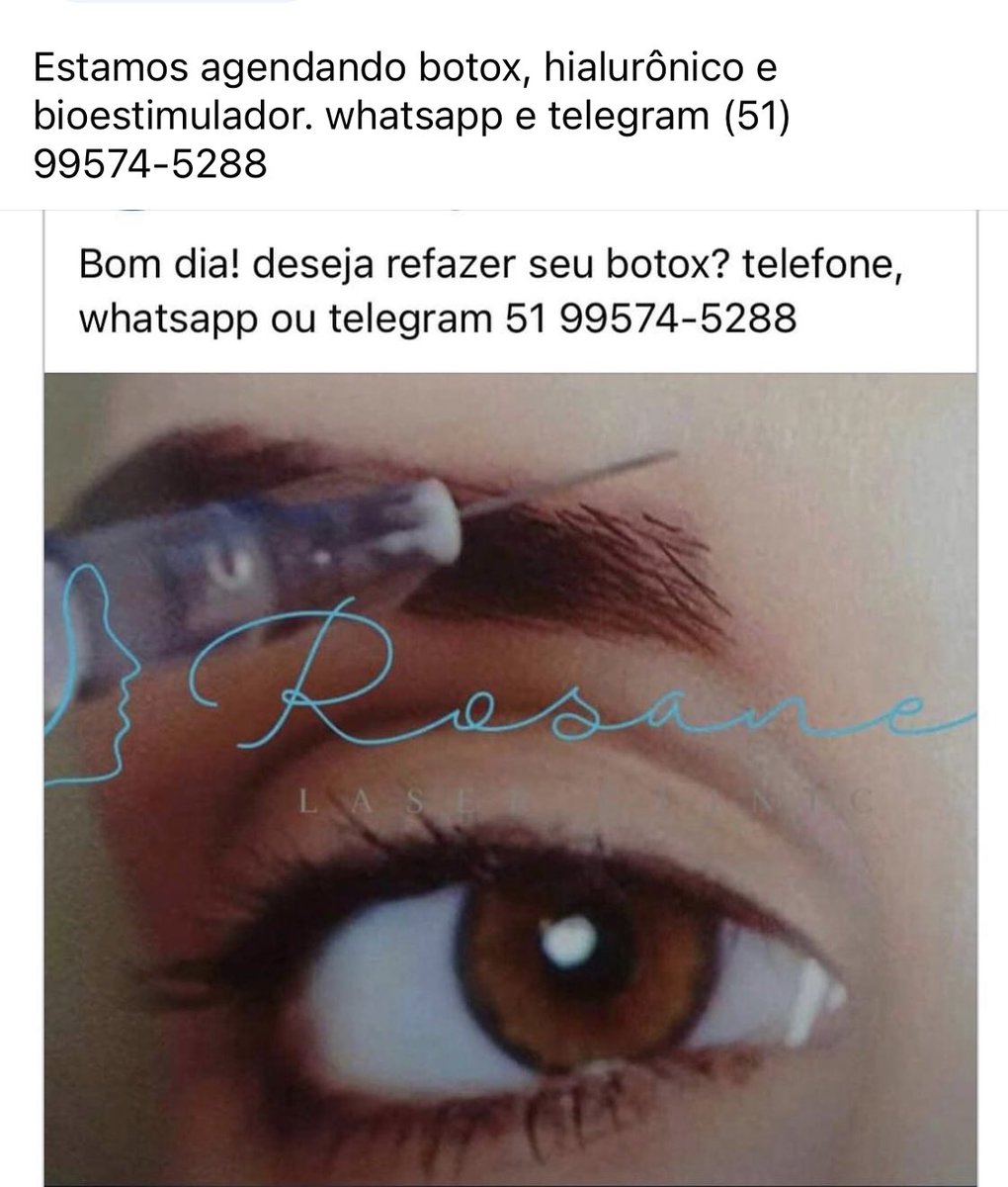 superlaserbr's tweet photo. #botoxemportoalegre                          https://t.co/PKCOAAmgvf https://t.co/IgH4Mc42wM