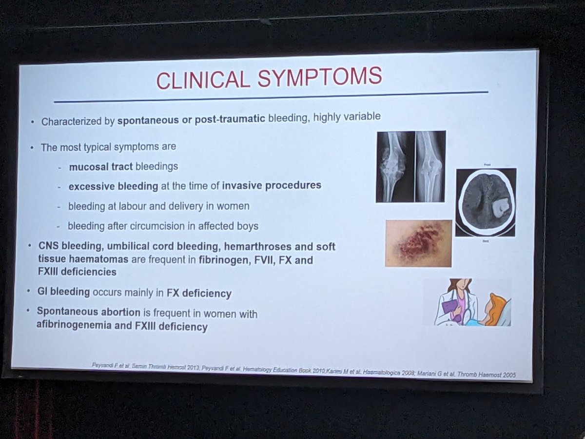Bleeding symptoms vary significantly both in severity &amp; specificity for rare bleeding disorders meaning we need to take a look at more than the numbers #WFHCongress2024