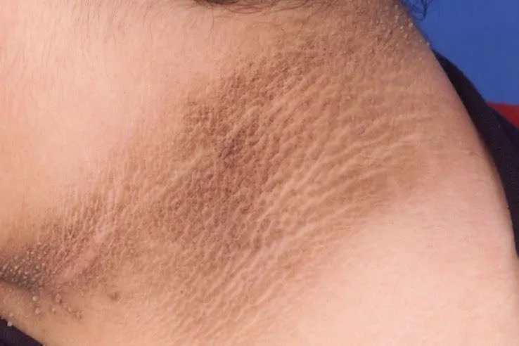 مَيساء | Miysa tweet media