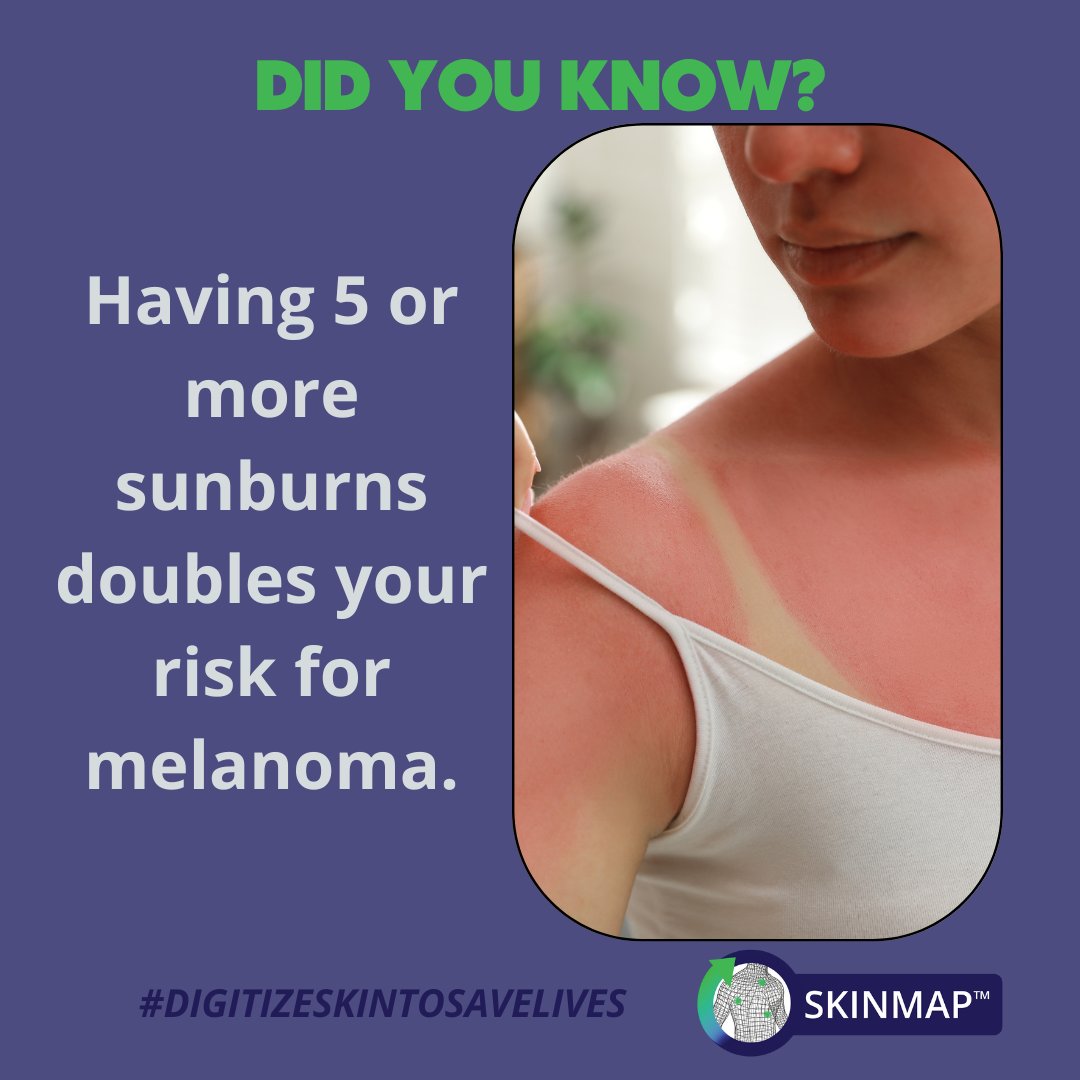Did you know that having 5 or more sunburns within your lifetime doubles your risk for #Melanoma? Skinmap's Total Body Photography system can help #Dermatologists keep tabs on your overall skin health. #SkinCancerPrevention @TriangulateLabs